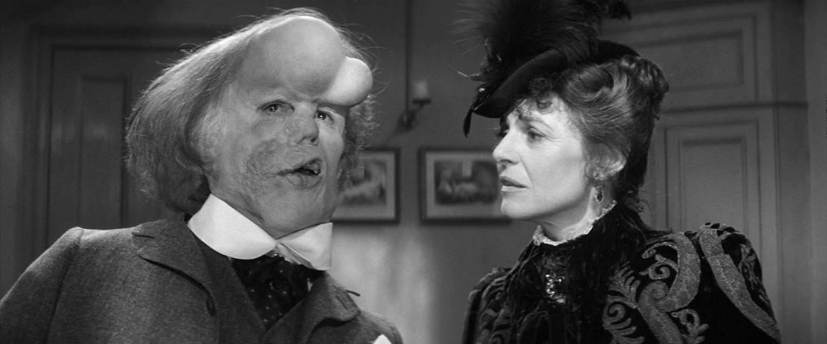 The elephant man - Quale mostro